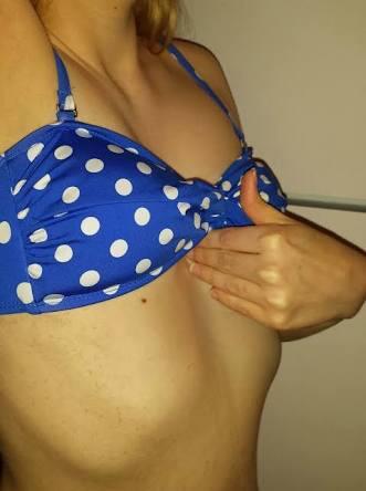 Fake boobs vs sunken chest?