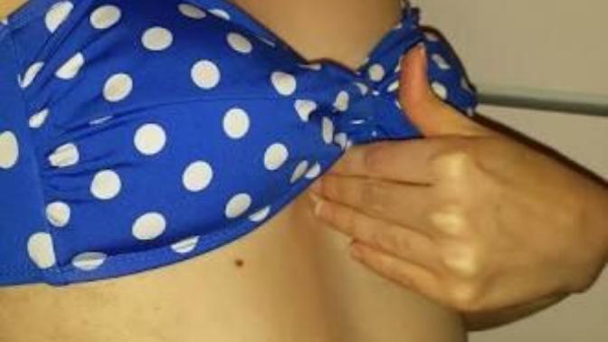 Fake boobs vs sunken chest?