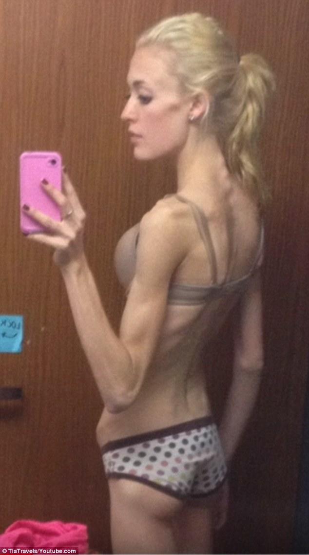 Should asking a happy-go-lucky question where you post your anorexic body on display (just skin and bones) be flagged for suicidal tendencies?
