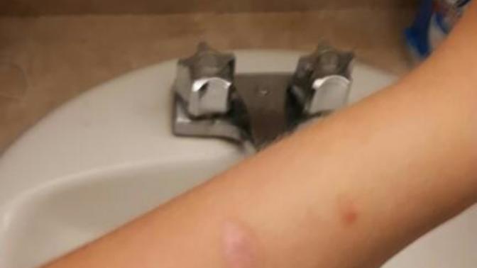 Self Harm Scars Visible... I have my first job interview tommorow with a modelling agency?