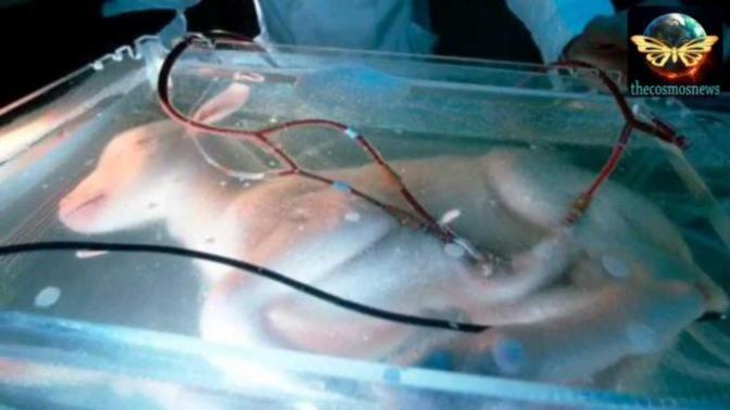 How do you feel about the approaching end of Abortion?