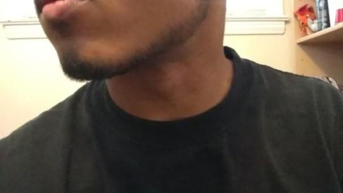 How does this cut look for my faceal hair 🤔 I can't grow a full beard😌?