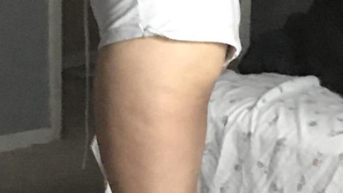 Advice on losing weight?