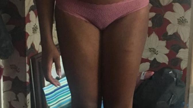 How can I lose weight asap (PICS)?