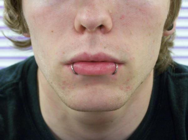 What Do You Think Of Snake Bite Piercings?