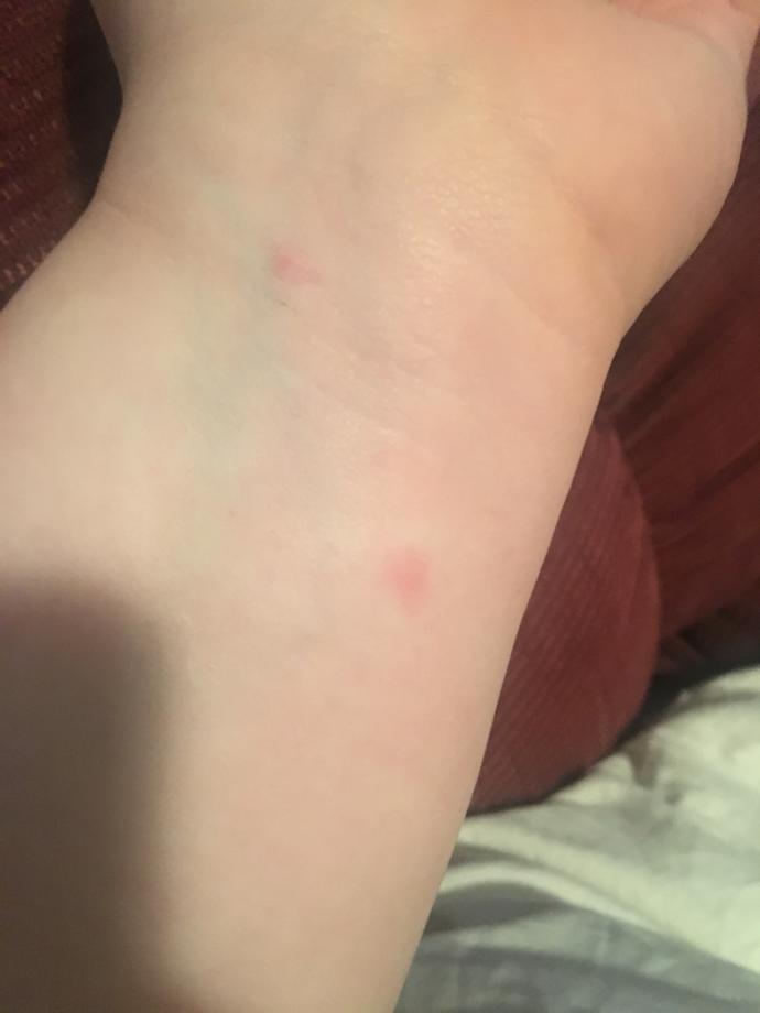 What are these itchy bumps on my arm and leg?
