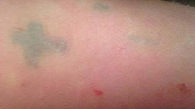 What's a good idea for a small tattoo to cover up something?