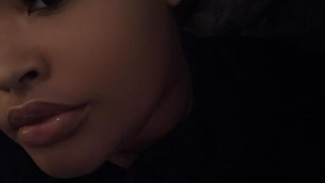 M shaped upper lip?