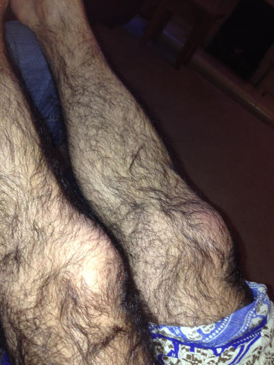 Should men remove their body hair, if to much?