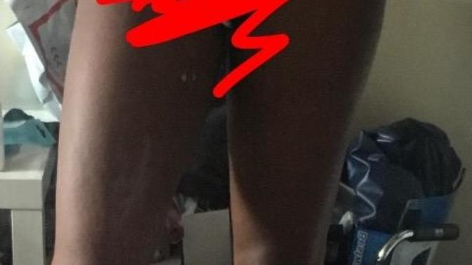 Any weight loss advice?