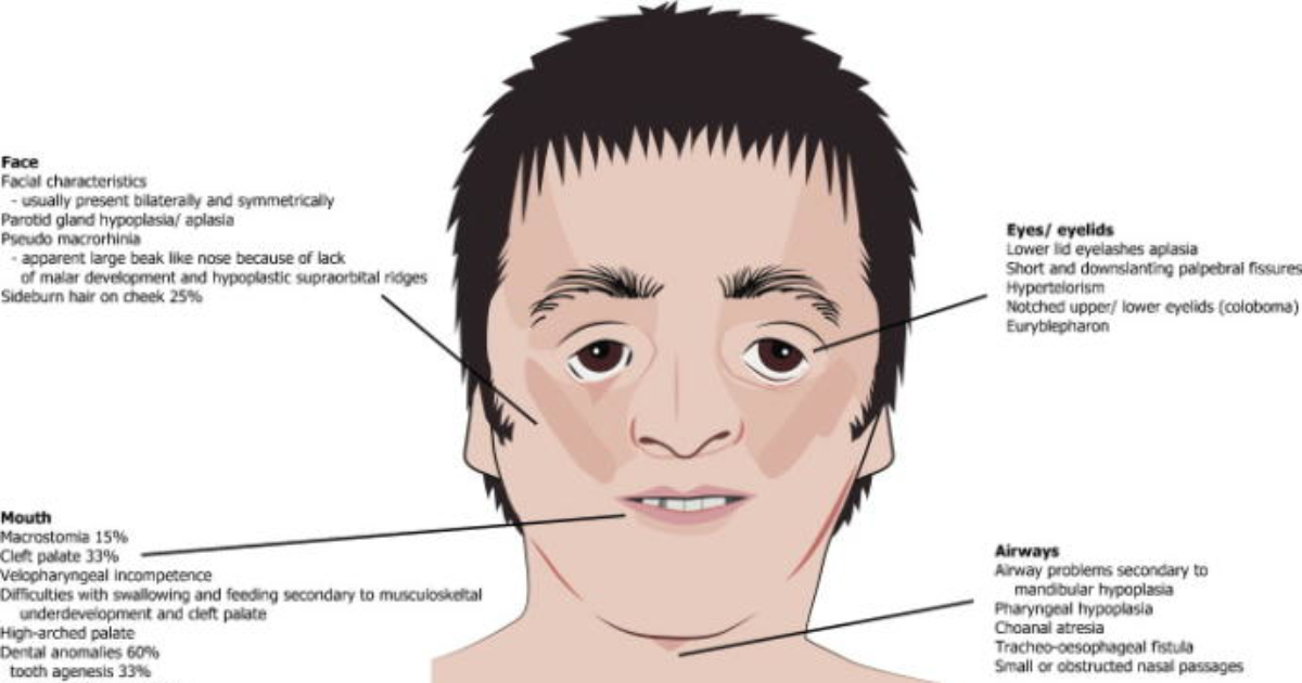 Facial characteristics of fas, hot women of the south pacific