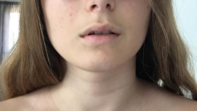 Should I get a septum piercing or a nostril ring?