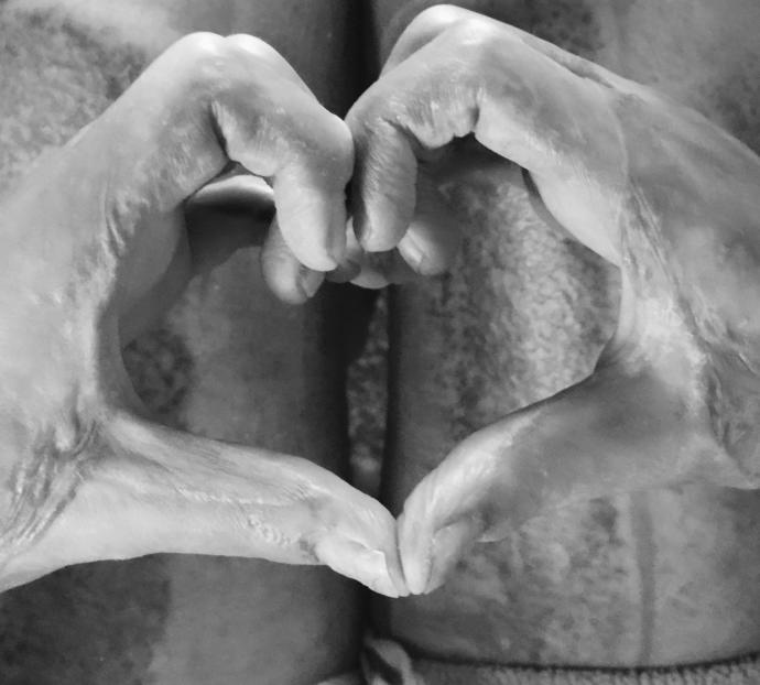 Guys, Are these scars Beautiful?