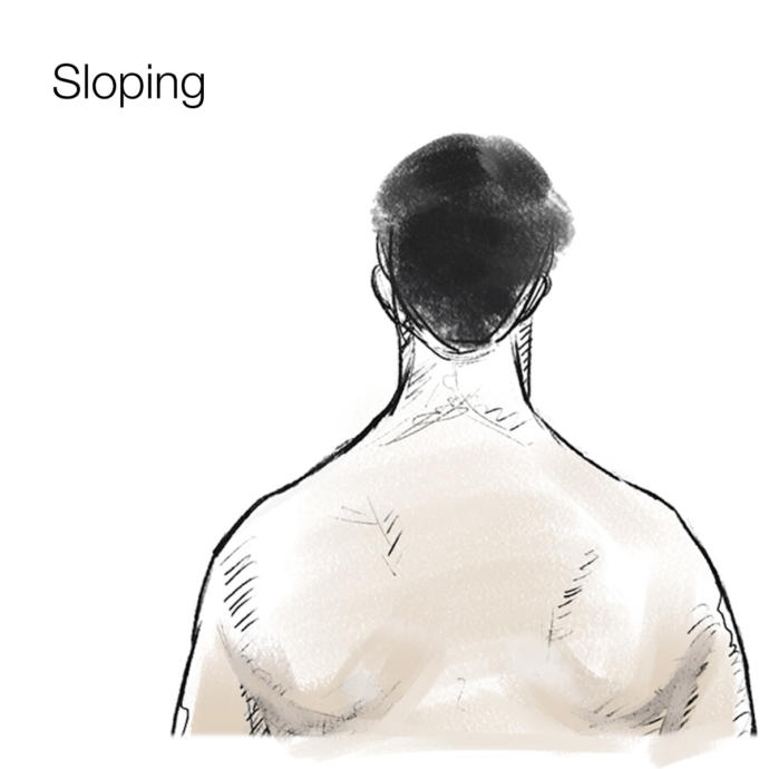 how can I fix stoop/sloping and narrow shoulders?help?
