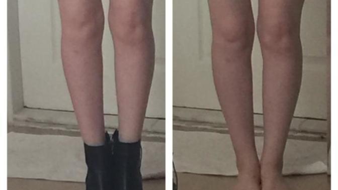 I hate my legs?