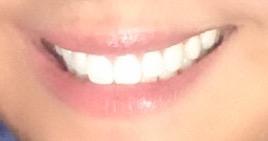 I have been told repeatedly by a guy that I have a nice/lovely smile. A smile that lights up the room. Do you agree?