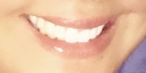 I have been told repeatedly by a guy that I have a nice/lovely smile. A smile that lights up the room. Do you agree?