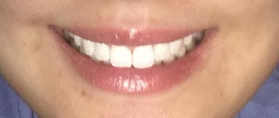I have been told repeatedly by a guy that I have a nice/lovely smile. A smile that lights up the room. Do you agree?