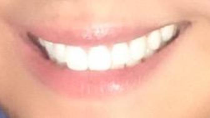 I have been told repeatedly by a guy that I have a nice/lovely smile. A smile that lights up the room. Do you agree?