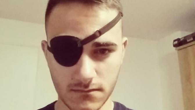 Girls, would u date a guy with an eye patch?
