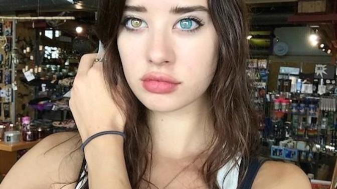 What do you think of two different colored eyes?