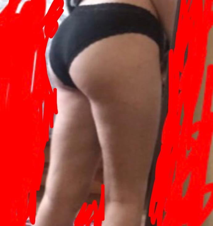 Guys, what's your opinion on a skinny girl that has cellulite?