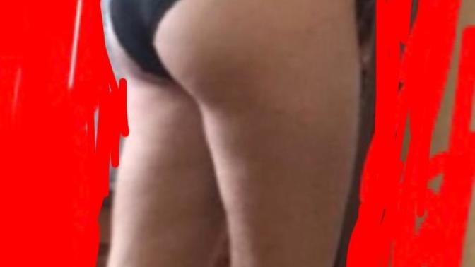 Guys, what's your opinion on a skinny girl that has cellulite?