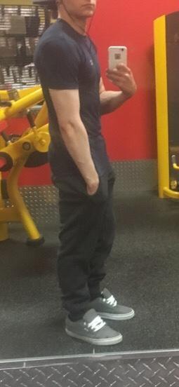 Rate my post-weight loss body, honestly please?