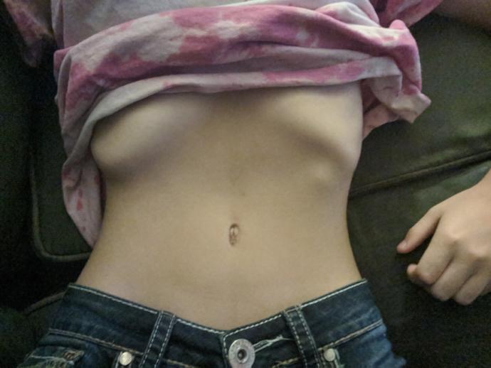Extra Rib on Lower Left Side?