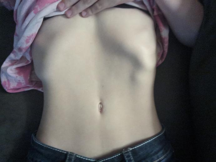 Extra Rib on Lower Left Side?