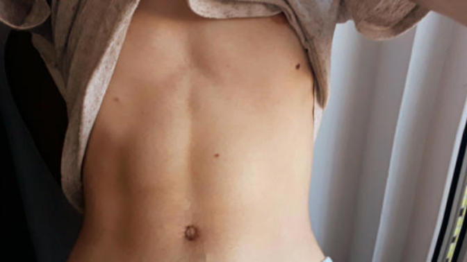 43 kg 95 ibs guy here. Do ilook too thin?