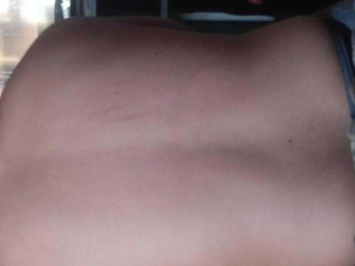 my boyfriend has back scratches and I think someone else did them (pic) ??