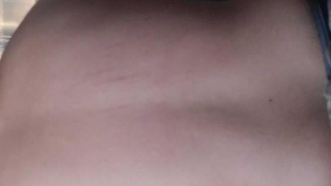 My boyfriend has back scratches and I think someone else did them (pic) ?