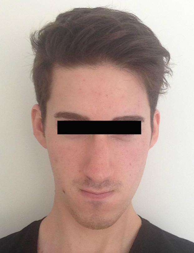 Rate my 2 year transformation from working out?