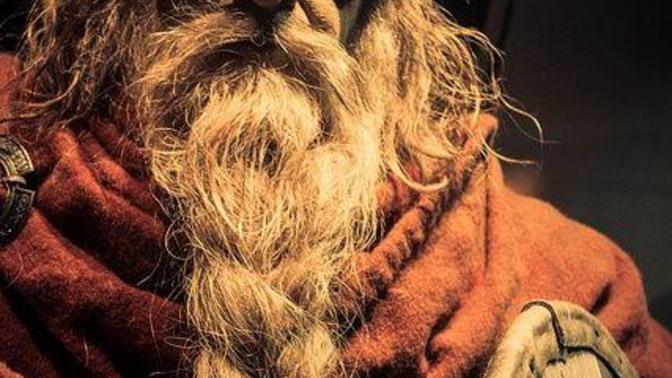 A strange case of beard?