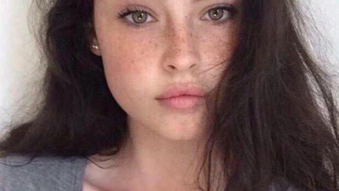 Are freckles pretty?