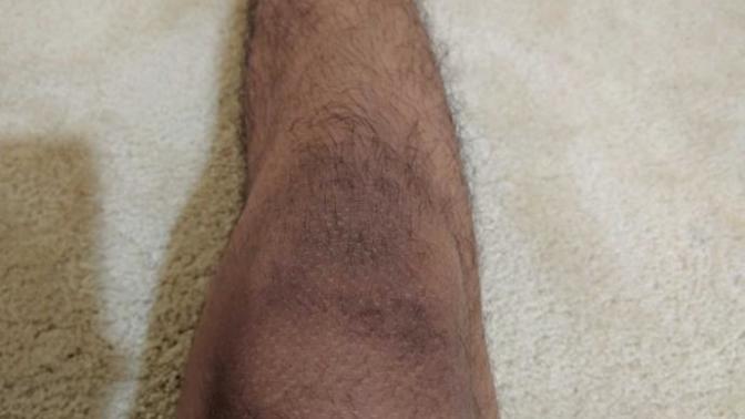 Should I shave my legs?