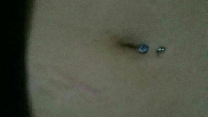 Stretch Marks... Immediate turn off?
