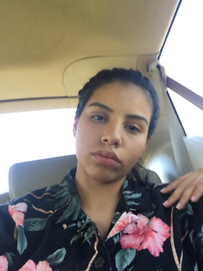 Does she have an androgynous face ?