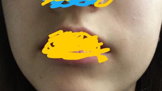 Are my cheeks chubby? (Ignore the scribbles on my nose and mouth)?