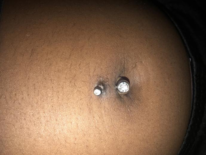 How to cure My belly piercing cause it's gross and infected ?