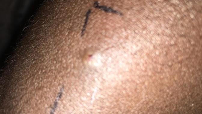 Any ideas what bug?