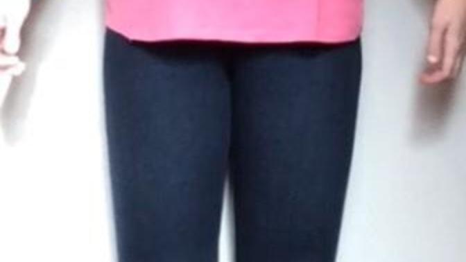 I feel like I am fat ( I have a eating disorder)?