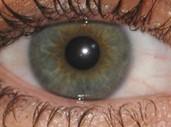 What is my eye color?