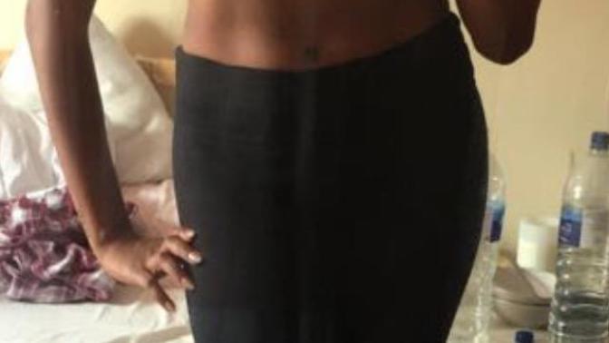 Cannot lose fat stomach! (PICS) What can I do to lose weight?
