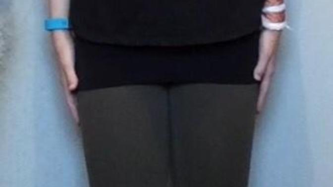 Should I lose weight?