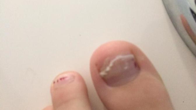 I cut my toenail halfway down will it grow back?