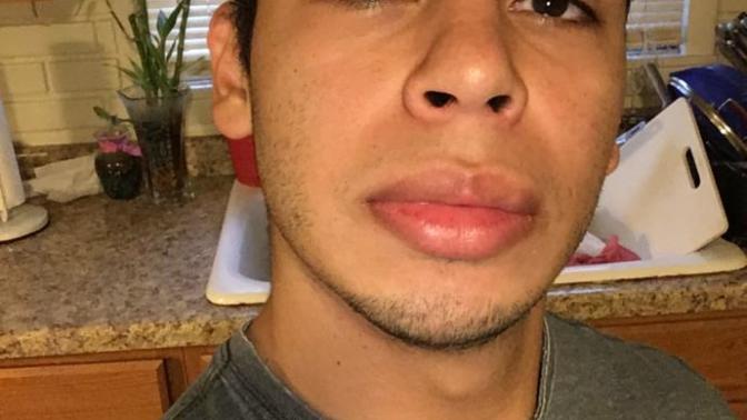 Are my lips too big?