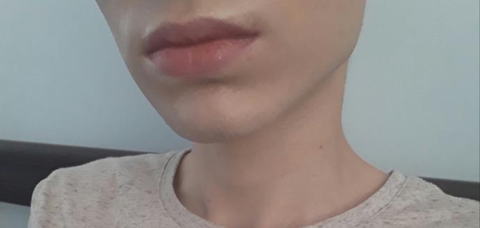 Do my lips look too thin?