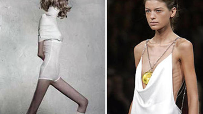 Should ultra-skinny models be banned from fashion modeling?